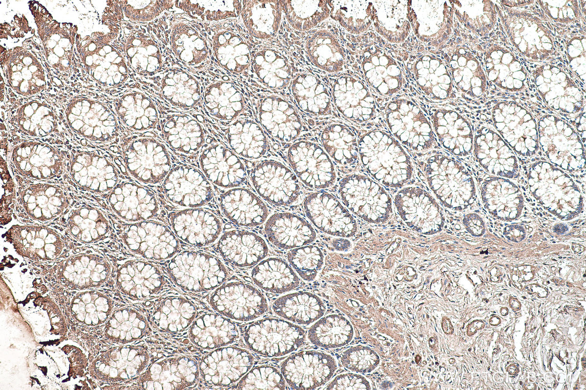 Immunohistochemical analysis of paraffin-embedded human colon tissue slide using KHC0563 (EEF1A2 IHC Kit).