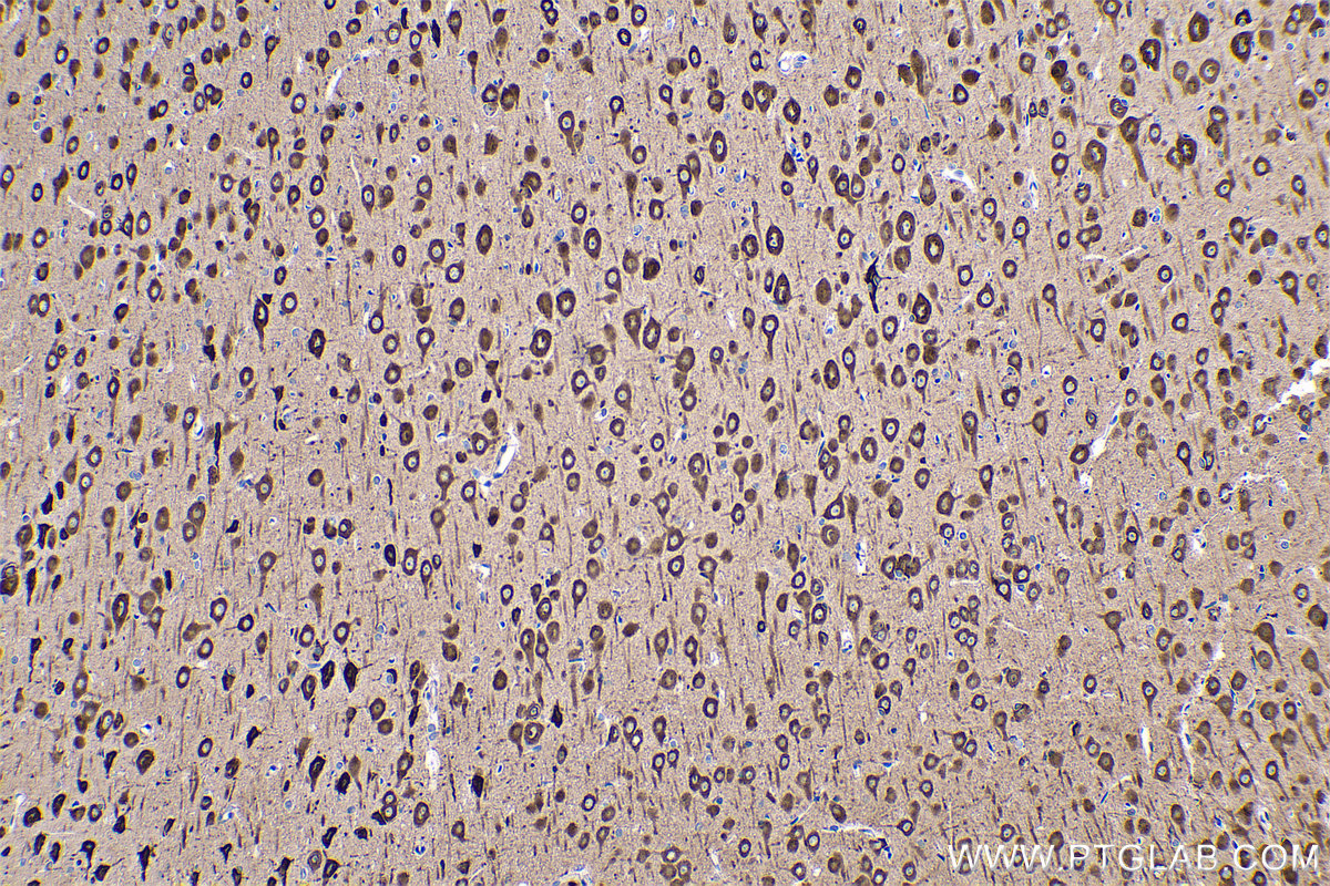 Immunohistochemical analysis of paraffin-embedded rat brain tissue slide using KHC0563 (EEF1A2 IHC Kit).