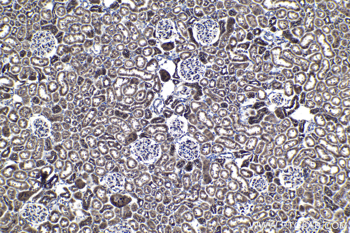 Immunohistochemical analysis of paraffin-embedded rat kidney tissue slide using KHC1171 (EEF1B2 IHC Kit).