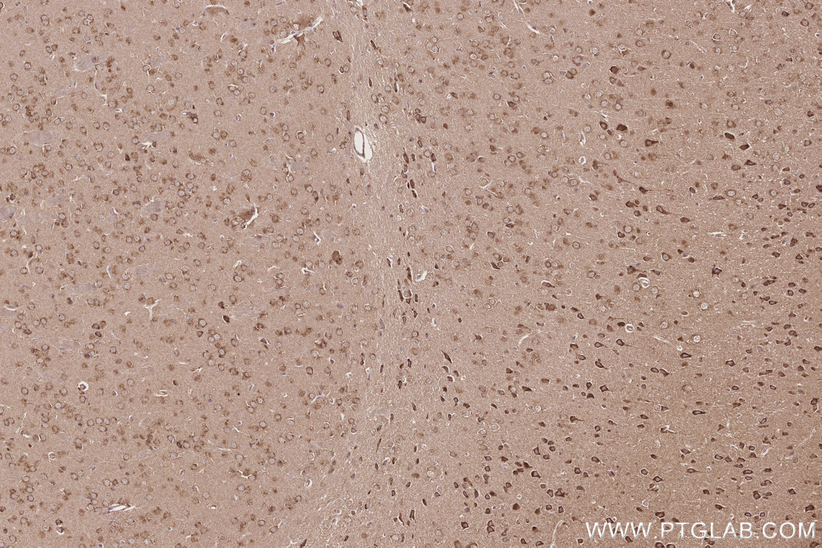 Immunohistochemical analysis of paraffin-embedded mouse brain tissue slide using KHC2855 (EIF2AK1 IHC Kit).