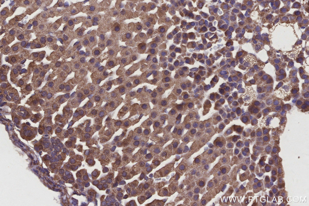 Immunohistochemical analysis of paraffin-embedded mouse adrenal gland tissue slide using KHC2855 (EIF2AK1 IHC Kit).