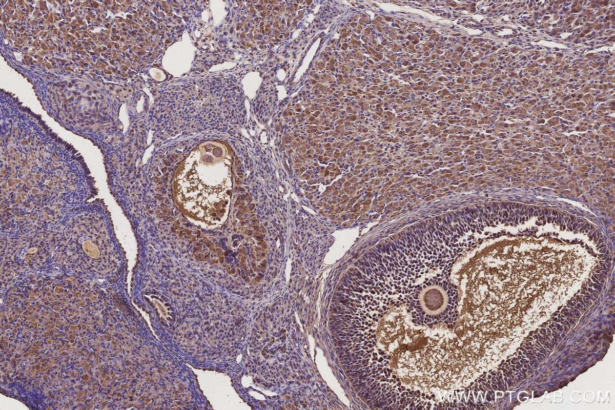 Immunohistochemical analysis of paraffin-embedded rat ovary tissue slide using KHC2855 (EIF2AK1 IHC Kit).