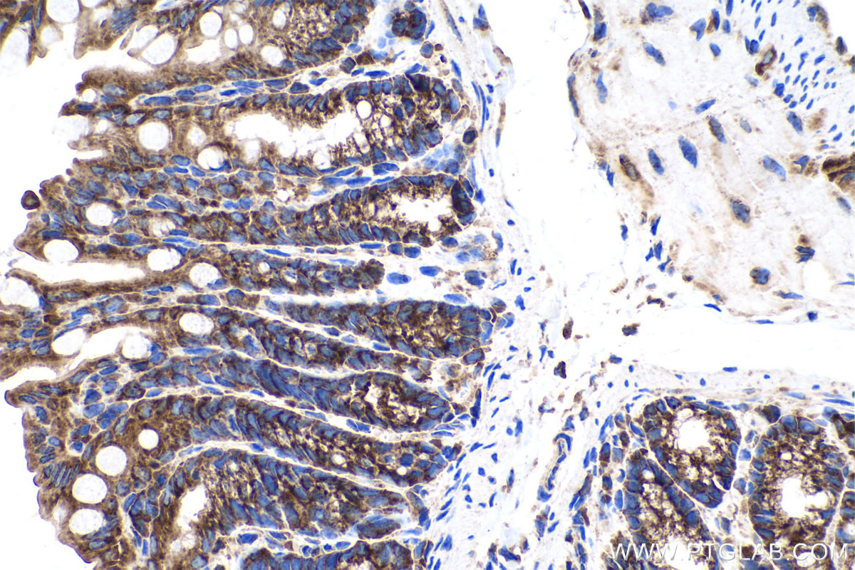 Immunohistochemical analysis of paraffin-embedded mouse colon tissue slide using KHC0167 (EIF3A IHC Kit).