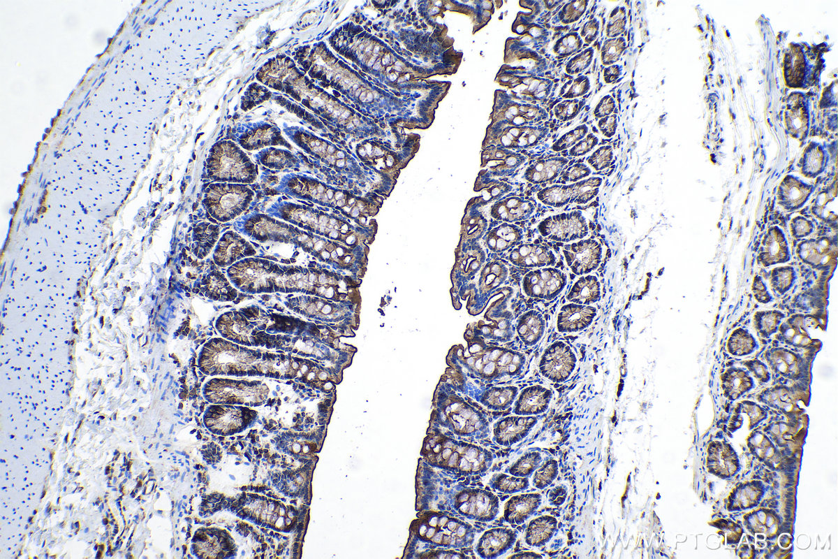 Immunohistochemical analysis of paraffin-embedded rat colon tissue slide using KHC0167 (EIF3A IHC Kit).