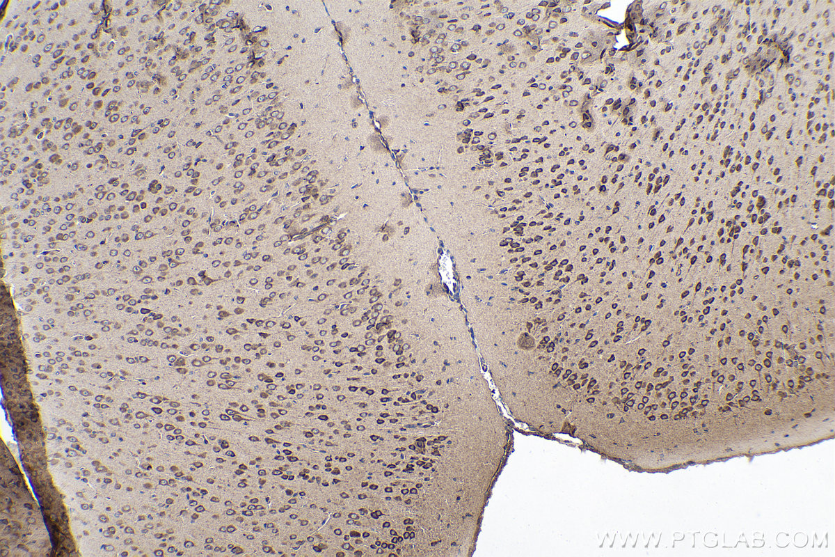 Immunohistochemical analysis of paraffin-embedded mouse brain tissue slide using KHC0168 (EIF3C IHC Kit).