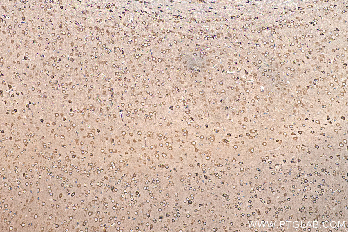 Immunohistochemical analysis of paraffin-embedded mouse brain tissue slide using KHC0169 (EIF3D IHC Kit).