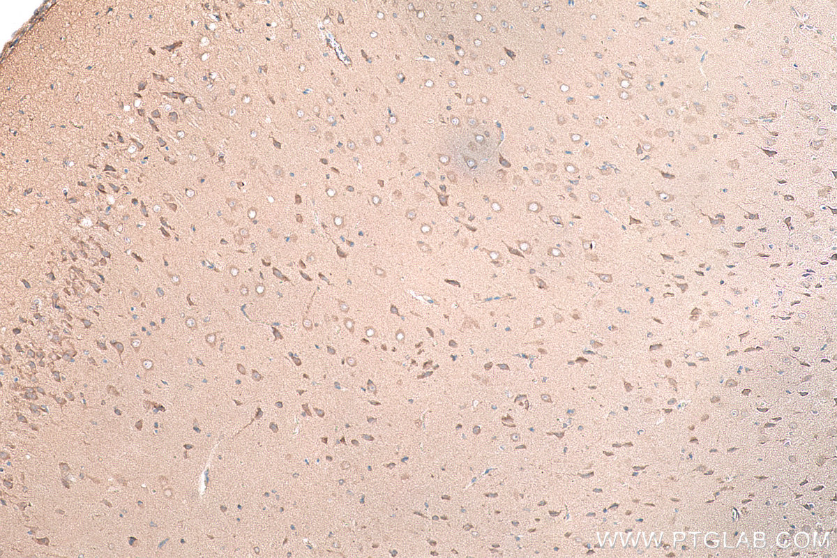 Immunohistochemical analysis of paraffin-embedded rat brain tissue slide using KHC0171 (EIF3I IHC Kit).