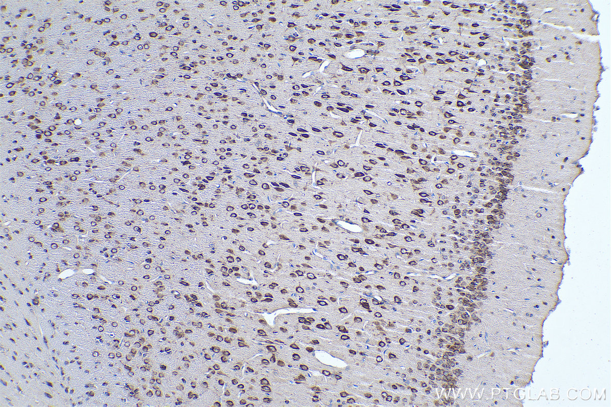 Immunohistochemical analysis of paraffin-embedded rat brain tissue slide using KHC0925 (EIF3M IHC Kit).