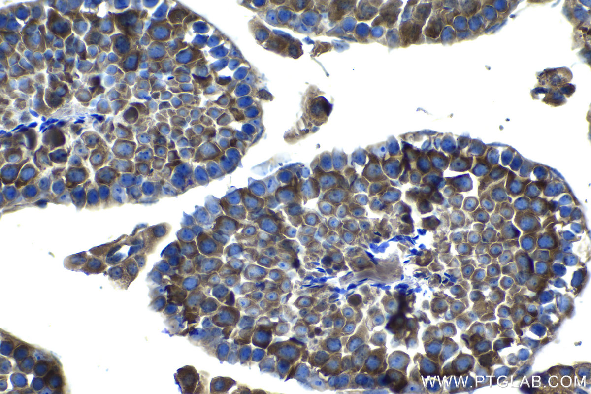 Immunohistochemical analysis of paraffin-embedded mouse testis tissue slide using KHC1204 (EIF4A2 IHC Kit).