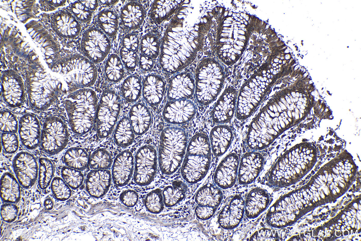 Immunohistochemical analysis of paraffin-embedded human colon tissue slide using KHC1204 (EIF4A2 IHC Kit).