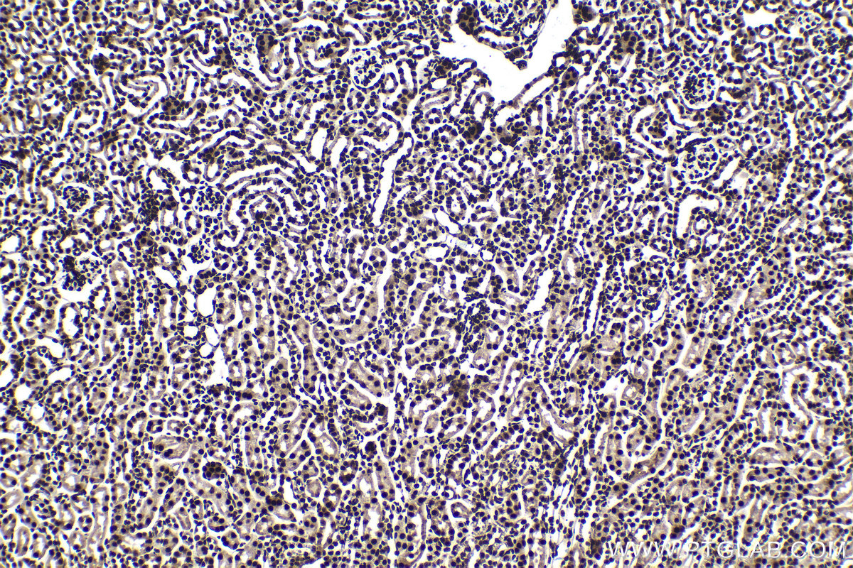 Immunohistochemical analysis of paraffin-embedded mouse kidney tissue slide using KHC1588 (EIF4A3 IHC Kit).