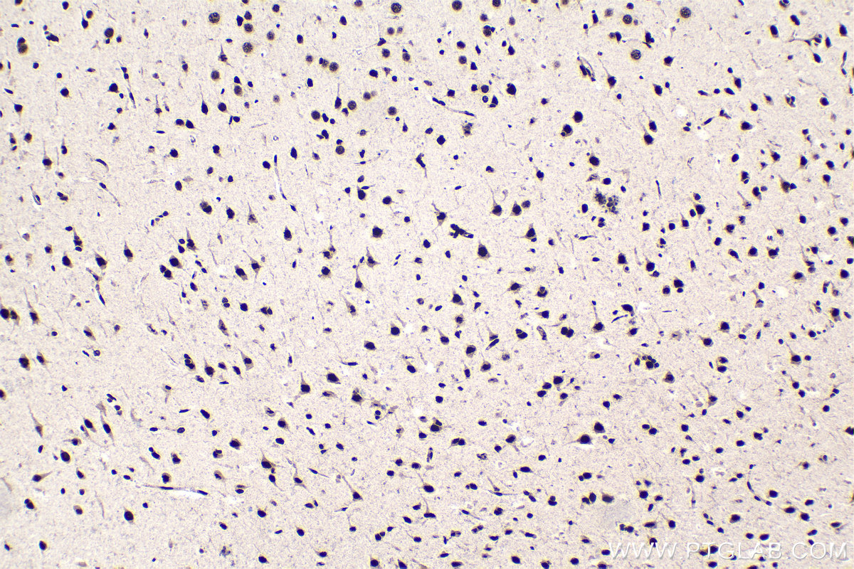 Immunohistochemical analysis of paraffin-embedded rat brain tissue slide using KHC1588 (EIF4A3 IHC Kit).