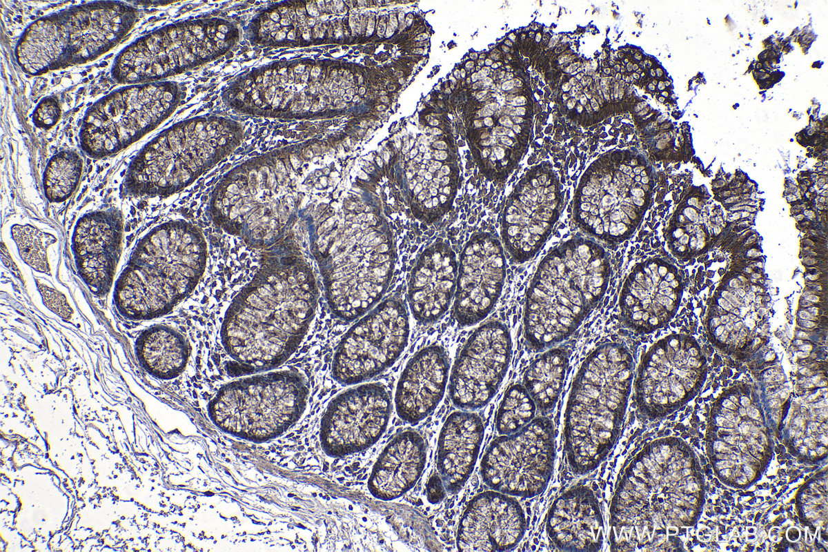 Immunohistochemical analysis of paraffin-embedded human colon tissue slide using KHC1205 (EIF4E IHC Kit).