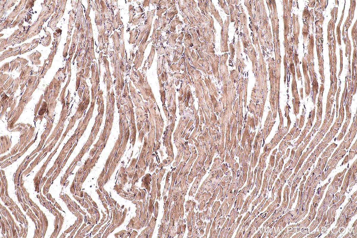 Immunohistochemical analysis of paraffin-embedded mouse heart tissue slide using KHC0927 (EIF4G2 IHC Kit).