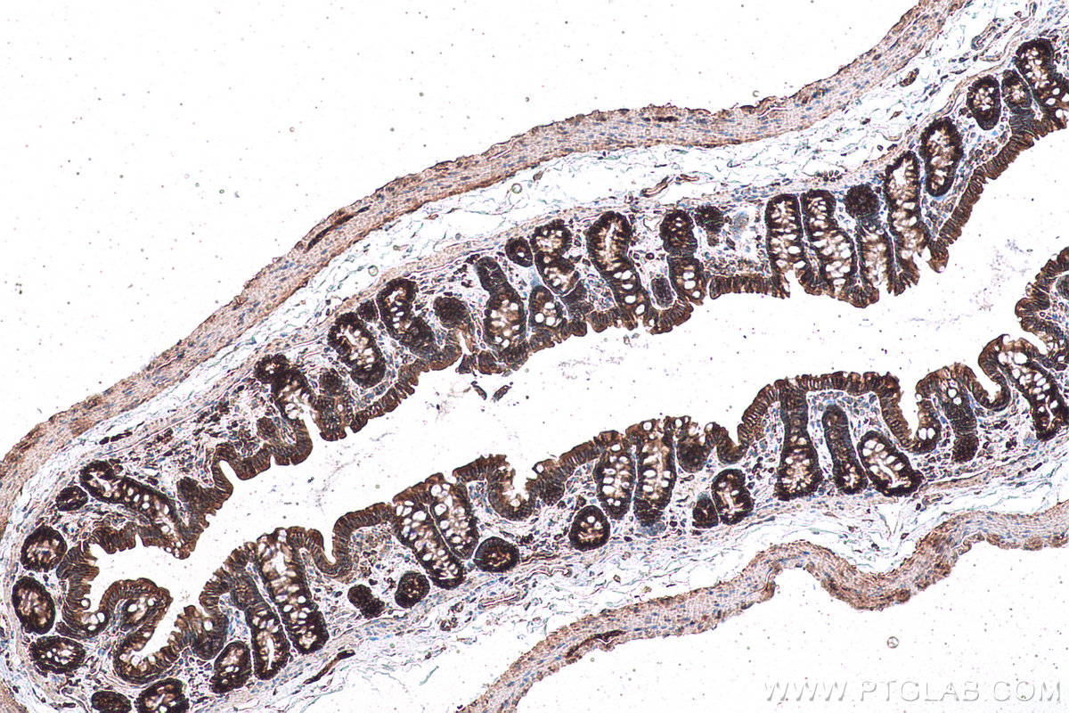 Immunohistochemical analysis of paraffin-embedded rat colon tissue slide using KHC0927 (EIF4G2 IHC Kit).