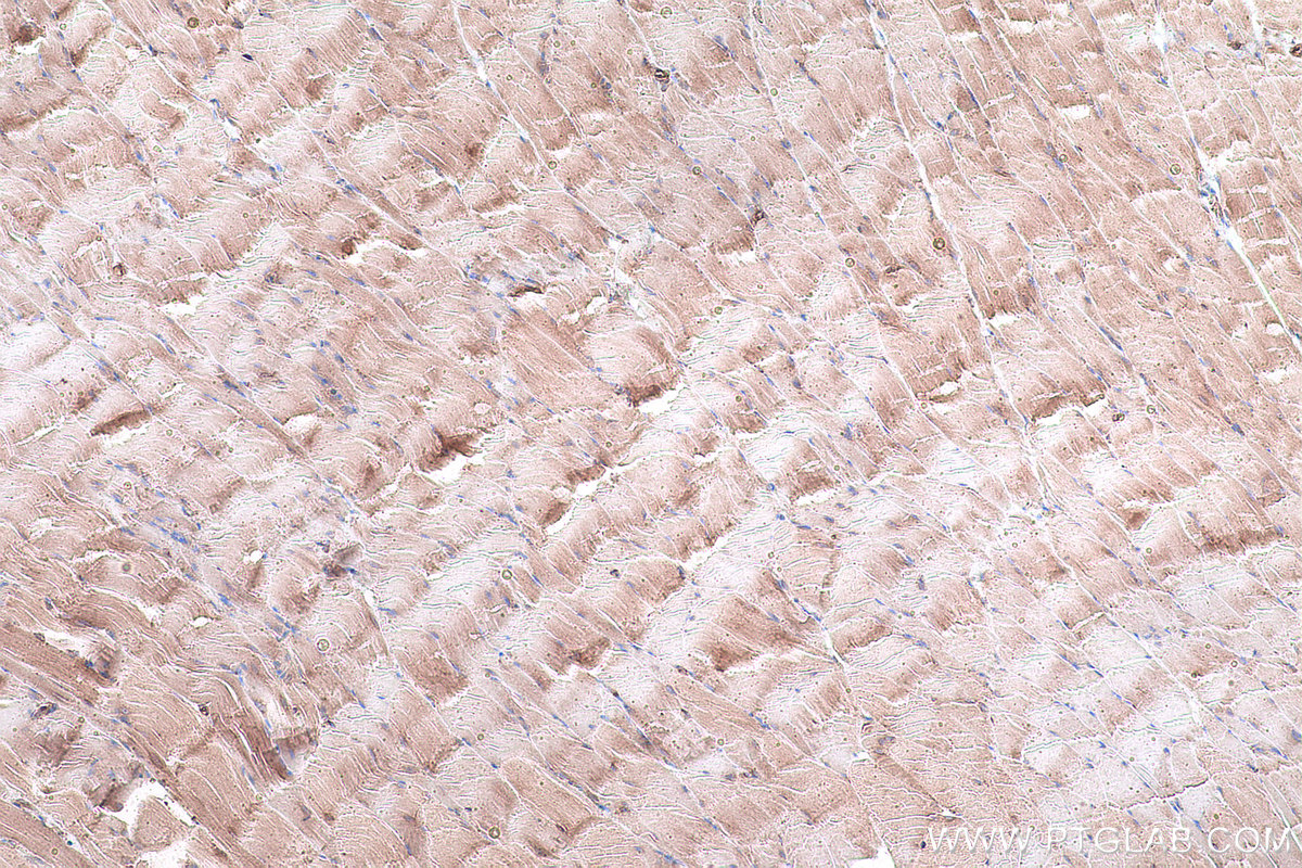 Immunohistochemical analysis of paraffin-embedded rat skeletal muscle tissue slide using KHC0927 (EIF4G2 IHC Kit).