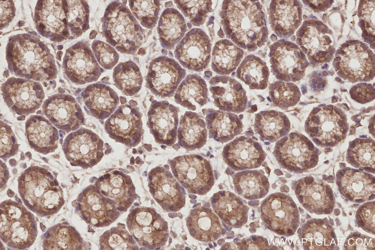 Immunohistochemical analysis of paraffin-embedded mouse colon tissue slide using KHC2896 (EIF5A1/EIF5A2 IHC Kit).