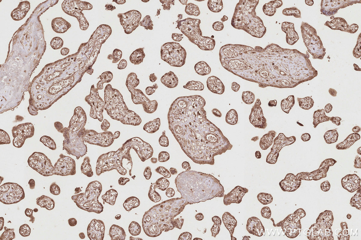 Immunohistochemical analysis of paraffin-embedded human placenta tissue slide using KHC2896 (EIF5A1/EIF5A2 IHC Kit).