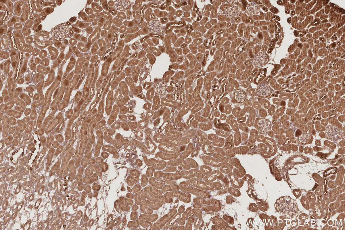 Immunohistochemical analysis of paraffin-embedded mouse kidney tissue slide using KHC2896 (EIF5A1/EIF5A2 IHC Kit).