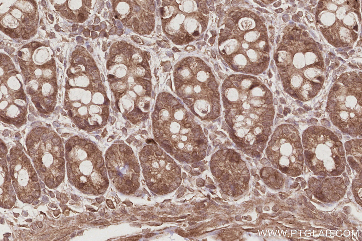 Immunohistochemical analysis of paraffin-embedded rat colon tissue slide using KHC2896 (EIF5A1/EIF5A2 IHC Kit).