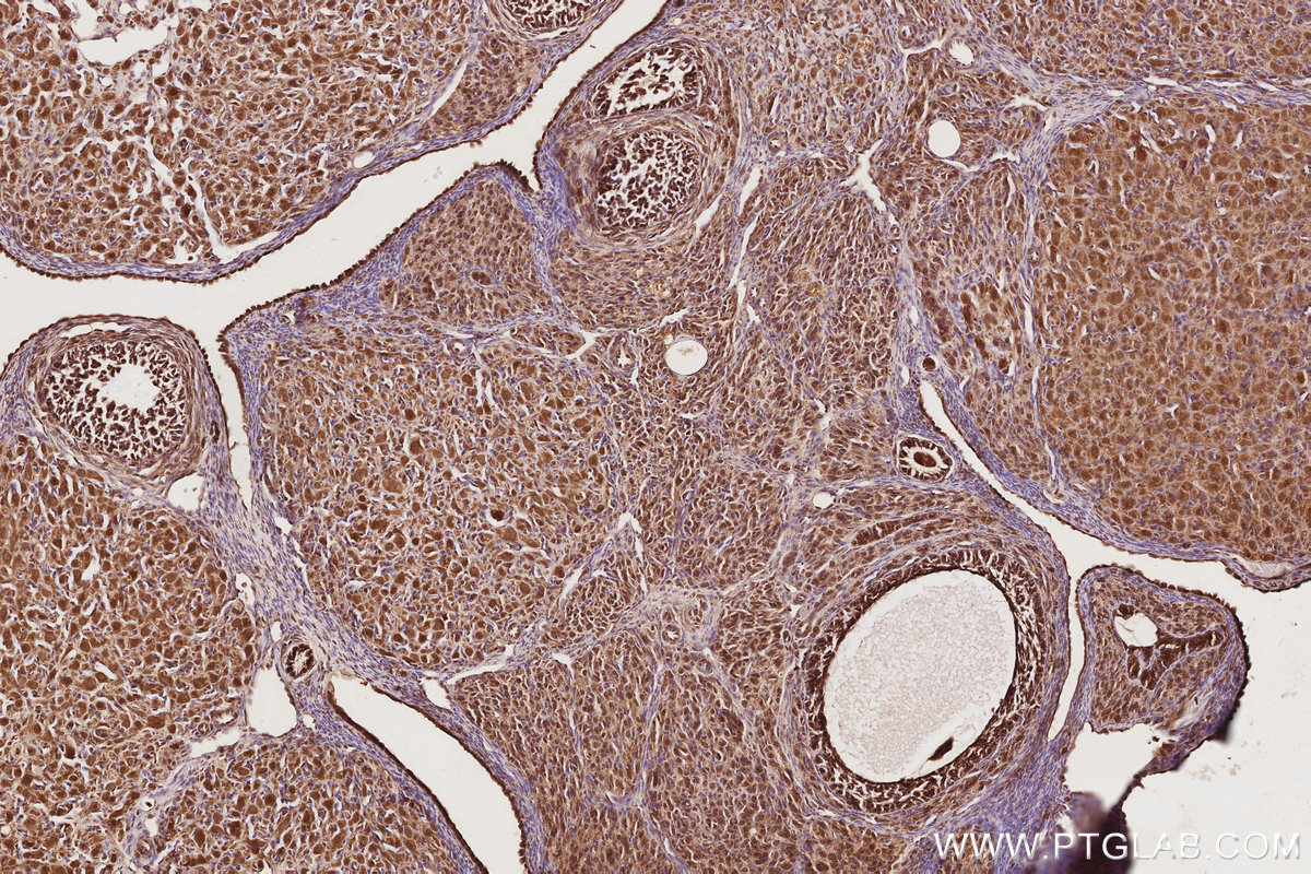 Immunohistochemical analysis of paraffin-embedded rat ovary tissue slide using KHC2896 (EIF5A1/EIF5A2 IHC Kit).