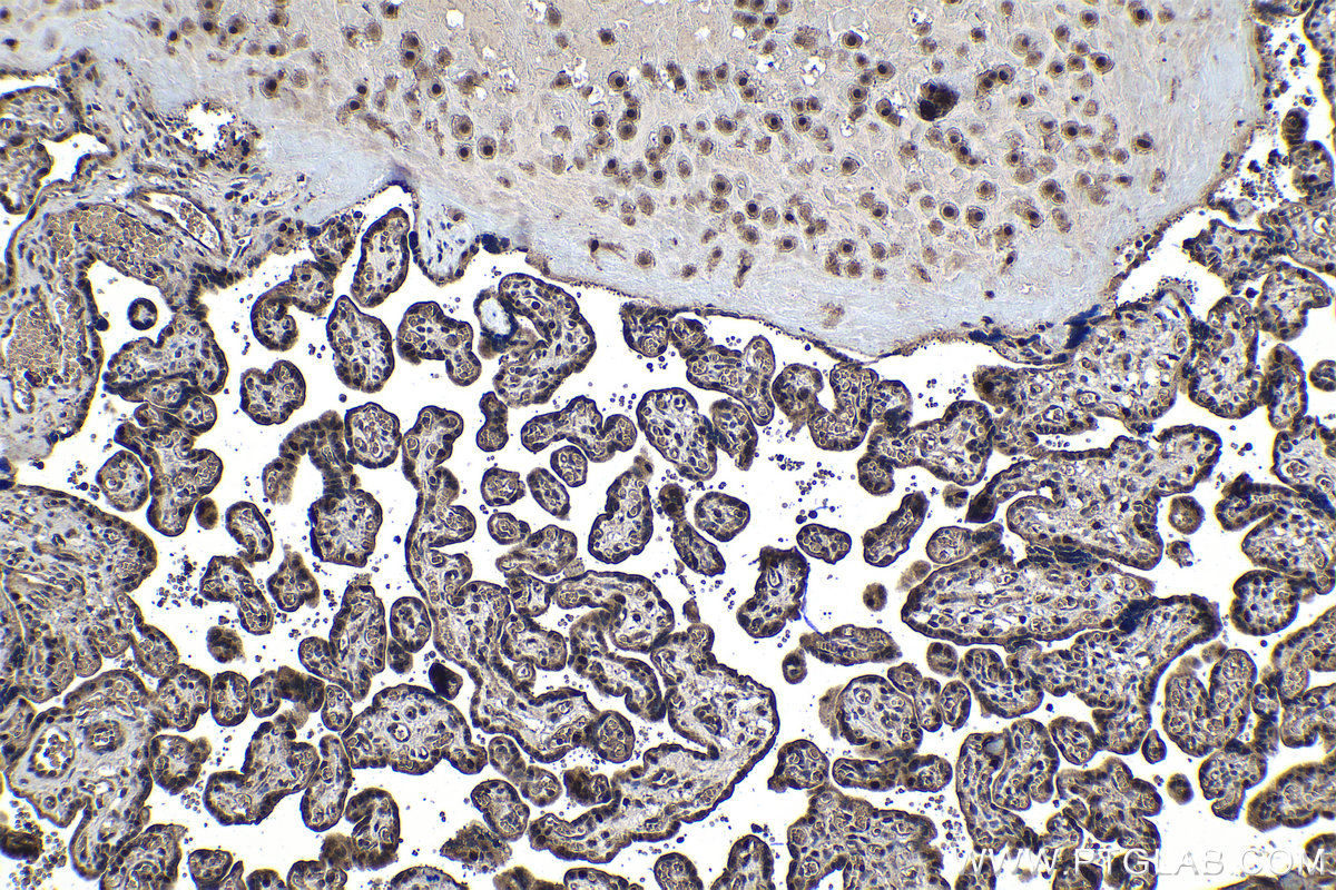 Immunohistochemical analysis of paraffin-embedded human placenta tissue slide using KHC1107 (ELAC2 IHC Kit).