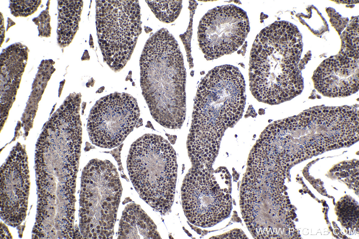 Immunohistochemical analysis of paraffin-embedded mouse testis tissue slide using KHC1107 (ELAC2 IHC Kit).