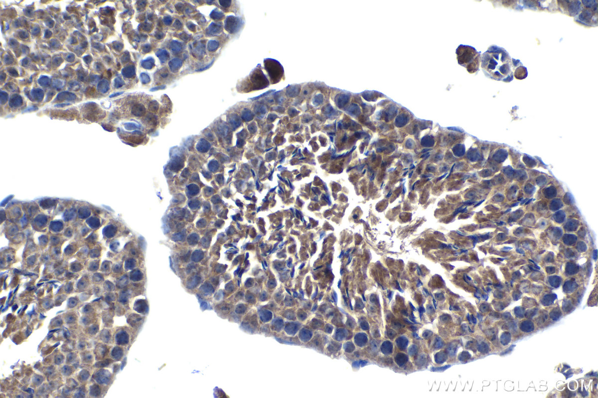 Immunohistochemical analysis of paraffin-embedded mouse testis tissue slide using KHC1345 (ELOVL2 IHC Kit).