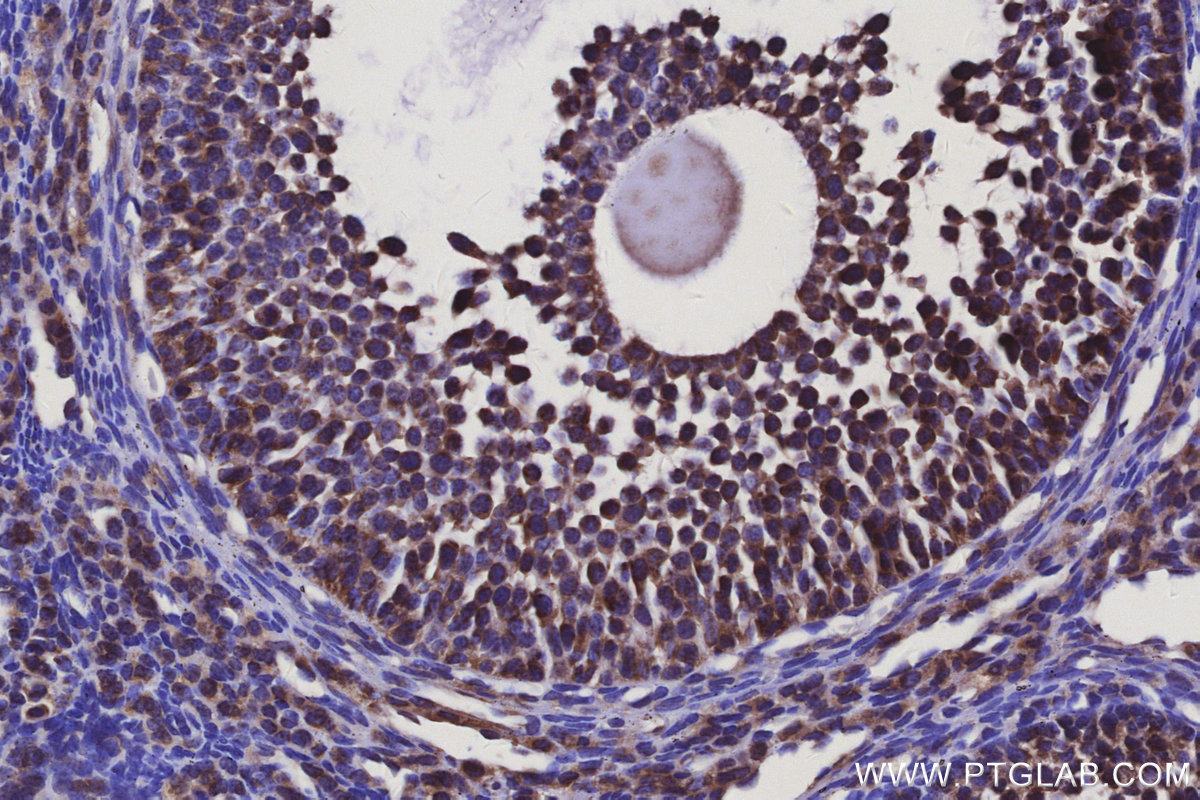 Immunohistochemical analysis of paraffin-embedded mouse ovary tissue slide using KHC3133 (ELOVL7 IHC Kit). Immunohistochemical analysis of paraffin-embedded mouse ovary tissue slide using KHC3133 (ELOVL7 IHC Kit).