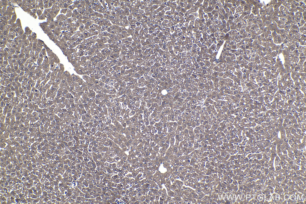 Immunohistochemical analysis of paraffin-embedded mouse liver tissue slide using KHC1020 (ELP2 IHC Kit).