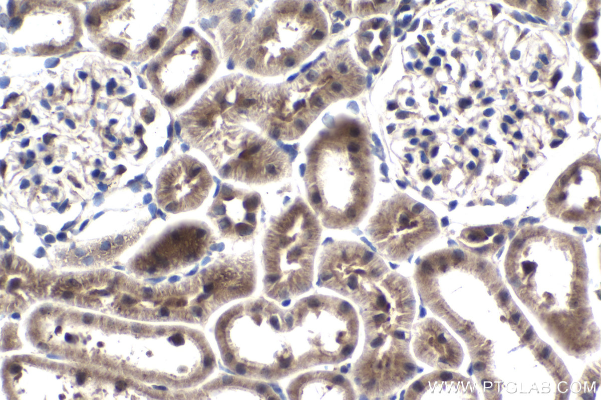 Immunohistochemical analysis of paraffin-embedded rat kidney tissue slide using KHC1020 (ELP2 IHC Kit).