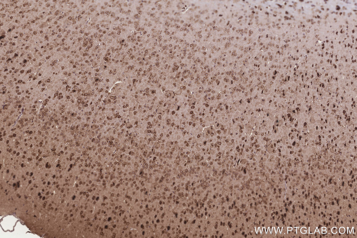 Immunohistochemical analysis of paraffin-embedded mouse brain tissue slide using KHC3254 (EMC2/TTC35 IHC Kit).