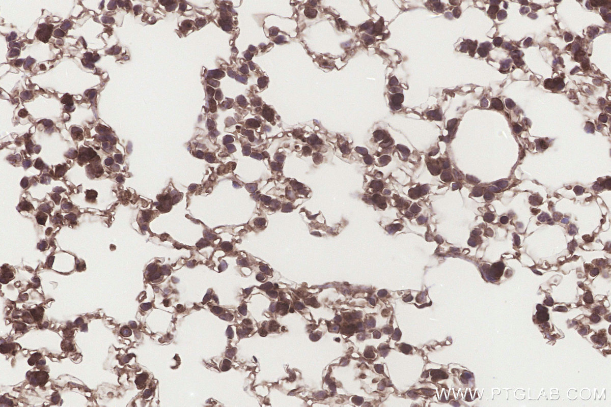 Immunohistochemical analysis of paraffin-embedded mouse lung tissue slide using KHC3254 (EMC2/TTC35 IHC Kit).