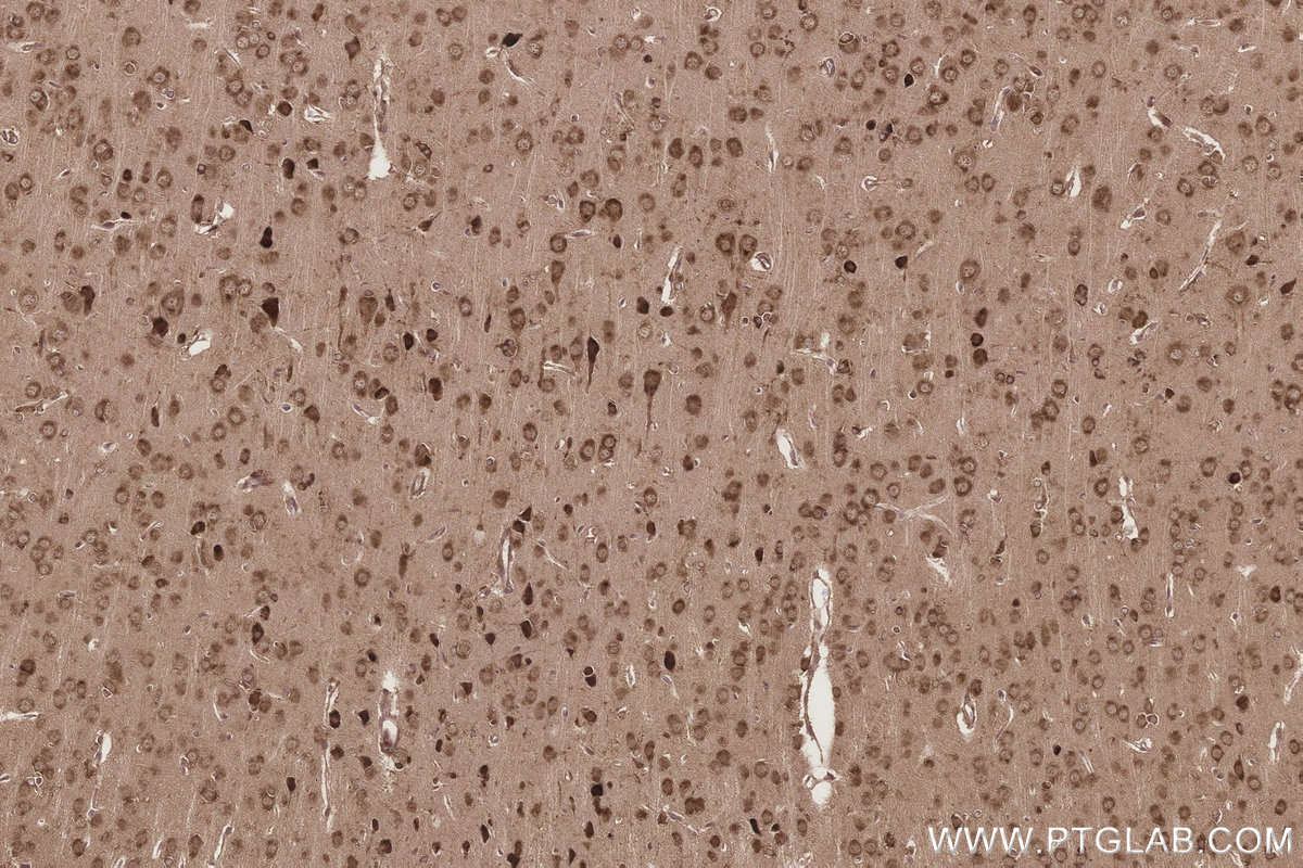 Immunohistochemical analysis of paraffin-embedded rat brain tissue slide using KHC3254 (EMC2/TTC35 IHC Kit).
