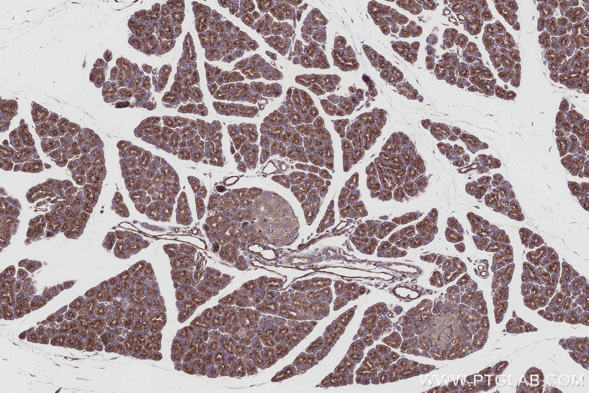 Immunohistochemical analysis of paraffin-embedded rat pancreas tissue slide using KHC2931 (EML4 IHC Kit). Immunohistochemical analysis of paraffin-embedded rat pancreas tissue slide using KHC2931 (EML4 IHC Kit).
