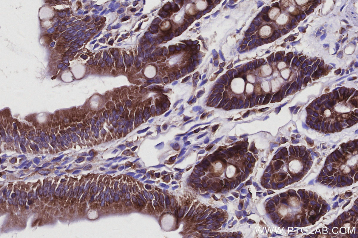 Immunohistochemical analysis of paraffin-embedded rat small intestine tissue slide using KHC2931 (EML4 IHC Kit). Immunohistochemical analysis of paraffin-embedded rat small intestine tissue slide using KHC2931 (EML4 IHC Kit).