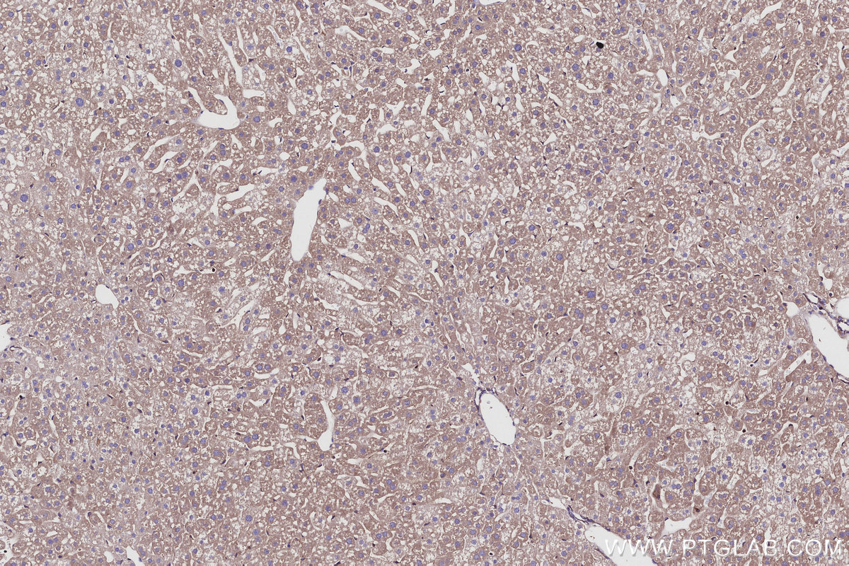 Immunohistochemical analysis of paraffin-embedded mouse liver tissue slide using KHC2931 (EML4 IHC Kit). Immunohistochemical analysis of paraffin-embedded mouse liver tissue slide using KHC2931 (EML4 IHC Kit).