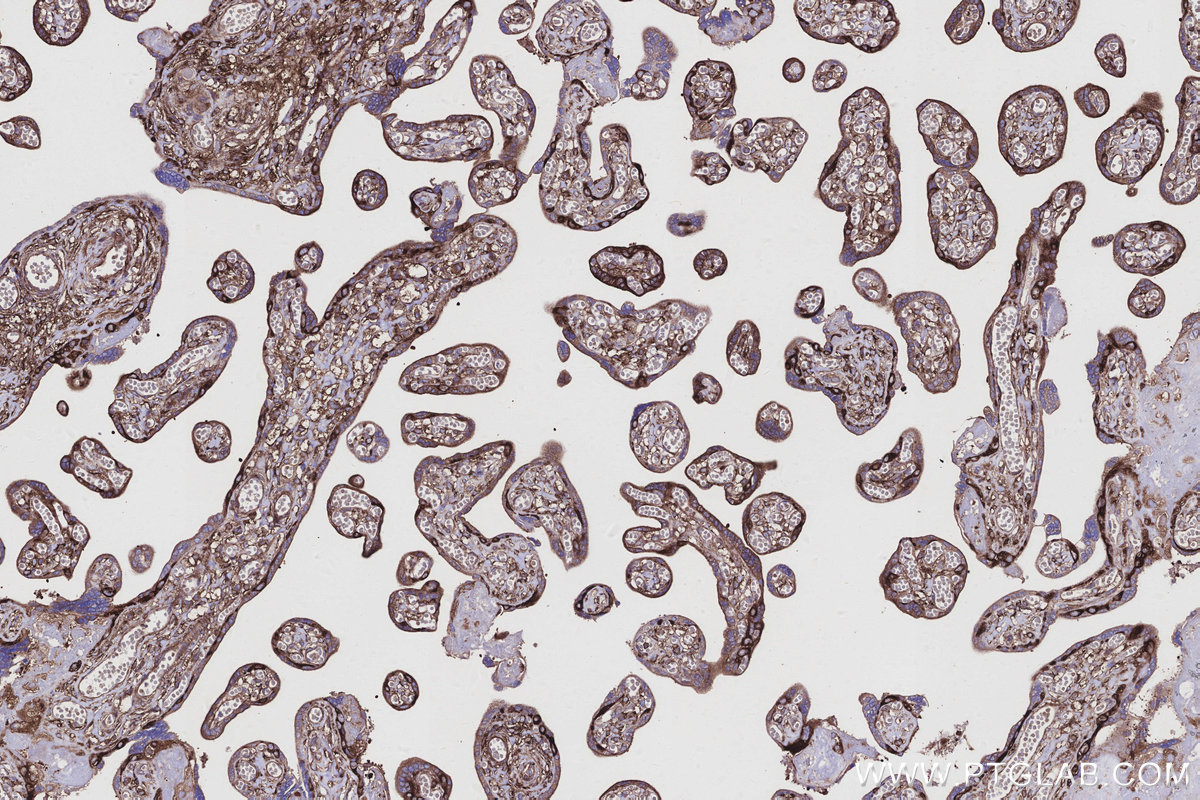 Immunohistochemical analysis of paraffin-embedded human placenta tissue slide using KHC2931 (EML4 IHC Kit). Immunohistochemical analysis of paraffin-embedded human placenta tissue slide using KHC2931 (EML4 IHC Kit).