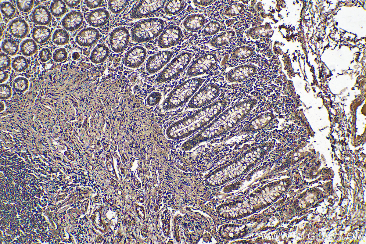 Immunohistochemical analysis of paraffin-embedded human colon tissue slide using KHC0656 (ENO1 IHC Kit).