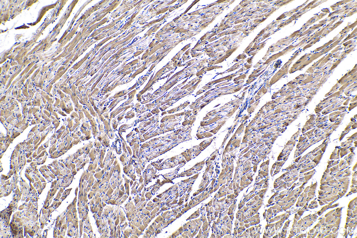 Immunohistochemical analysis of paraffin-embedded rat heart tissue slide using KHC0587 (ENO3 IHC Kit).