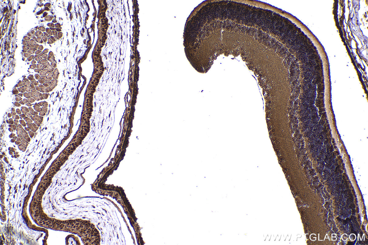 Immunohistochemical analysis of paraffin-embedded mouse eye tissue slide using KHC2177 (EPB41 IHC Kit).