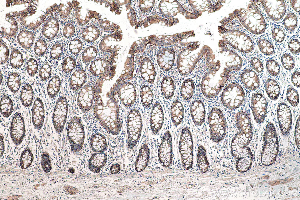 Immunohistochemical analysis of paraffin-embedded human colon tissue slide using KHC0085 (EPCAM/CD326 IHC Kit).