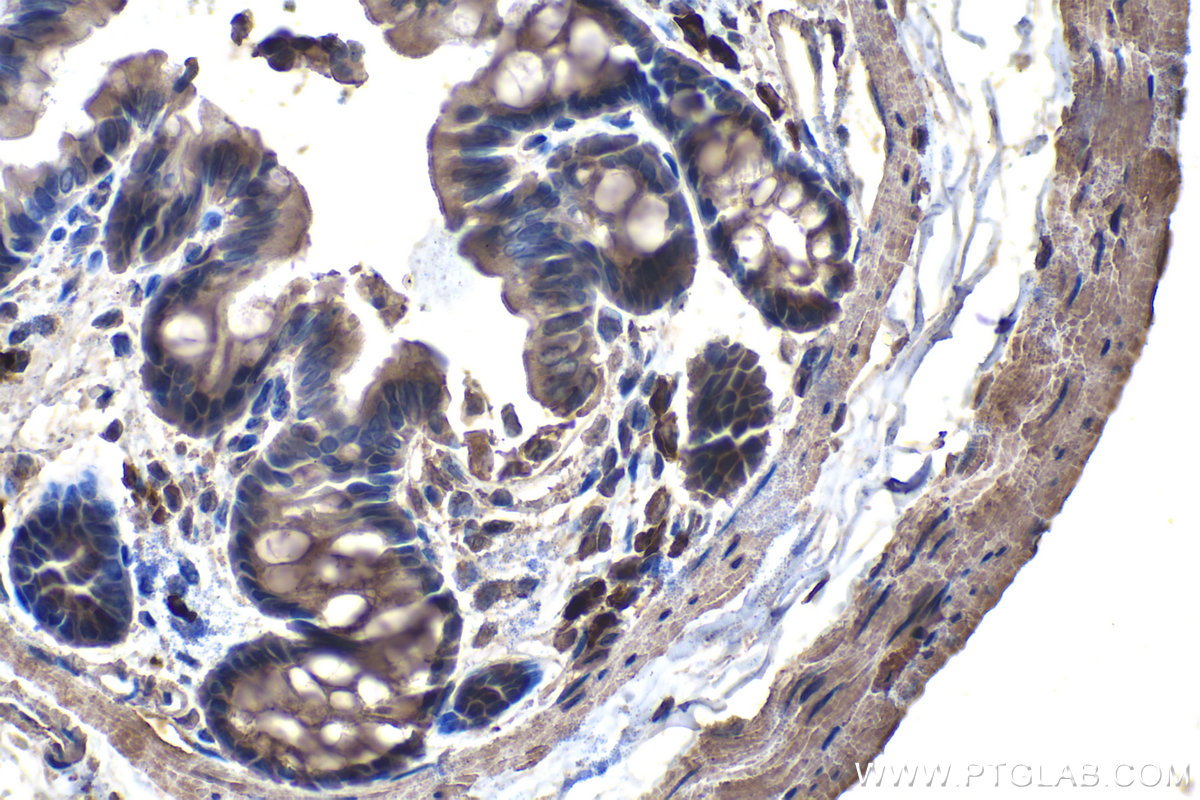 Immunohistochemical analysis of paraffin-embedded rat colon tissue slide using KHC1437 (EPHX2 IHC Kit).