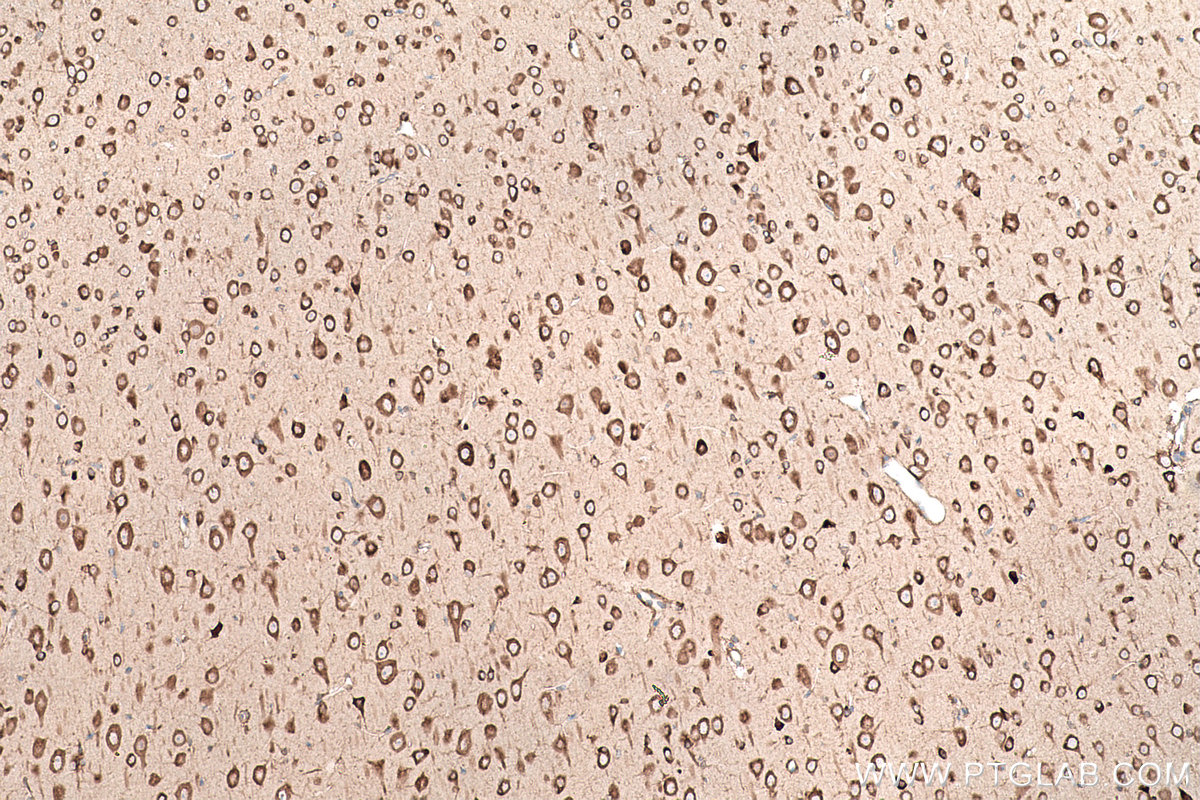 Immunohistochemical analysis of paraffin-embedded rat brain tissue slide using KHC0869 (EPRS IHC Kit).