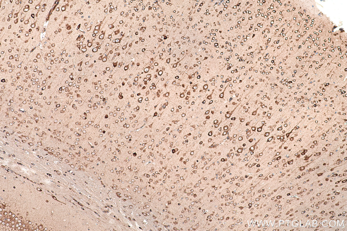 Immunohistochemical analysis of paraffin-embedded mouse brain tissue slide using KHC0869 (EPRS IHC Kit).