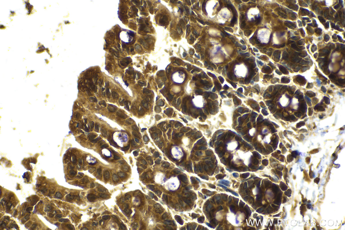 Immunohistochemical analysis of paraffin-embedded mouse intestine tissue slide using KHC2117 (ERAL1 IHC Kit).