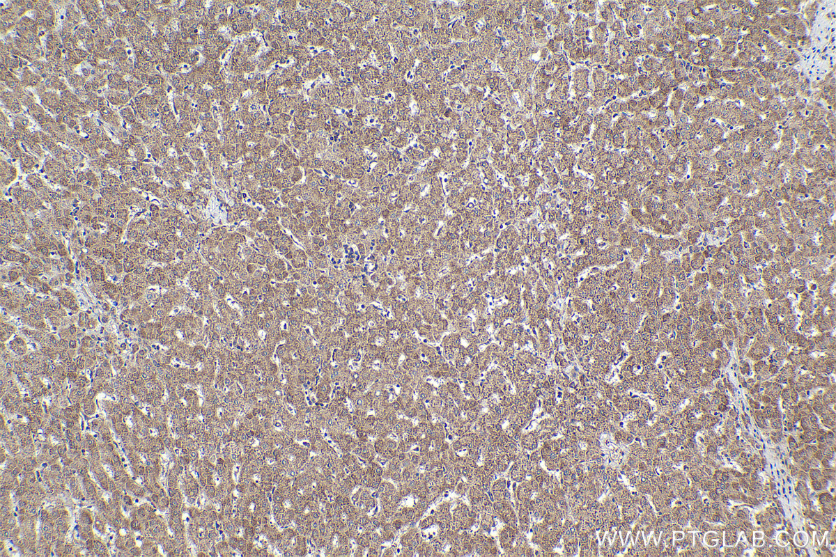 Immunohistochemical analysis of paraffin-embedded human liver tissue slide using KHC1883 (ERBIN IHC Kit).