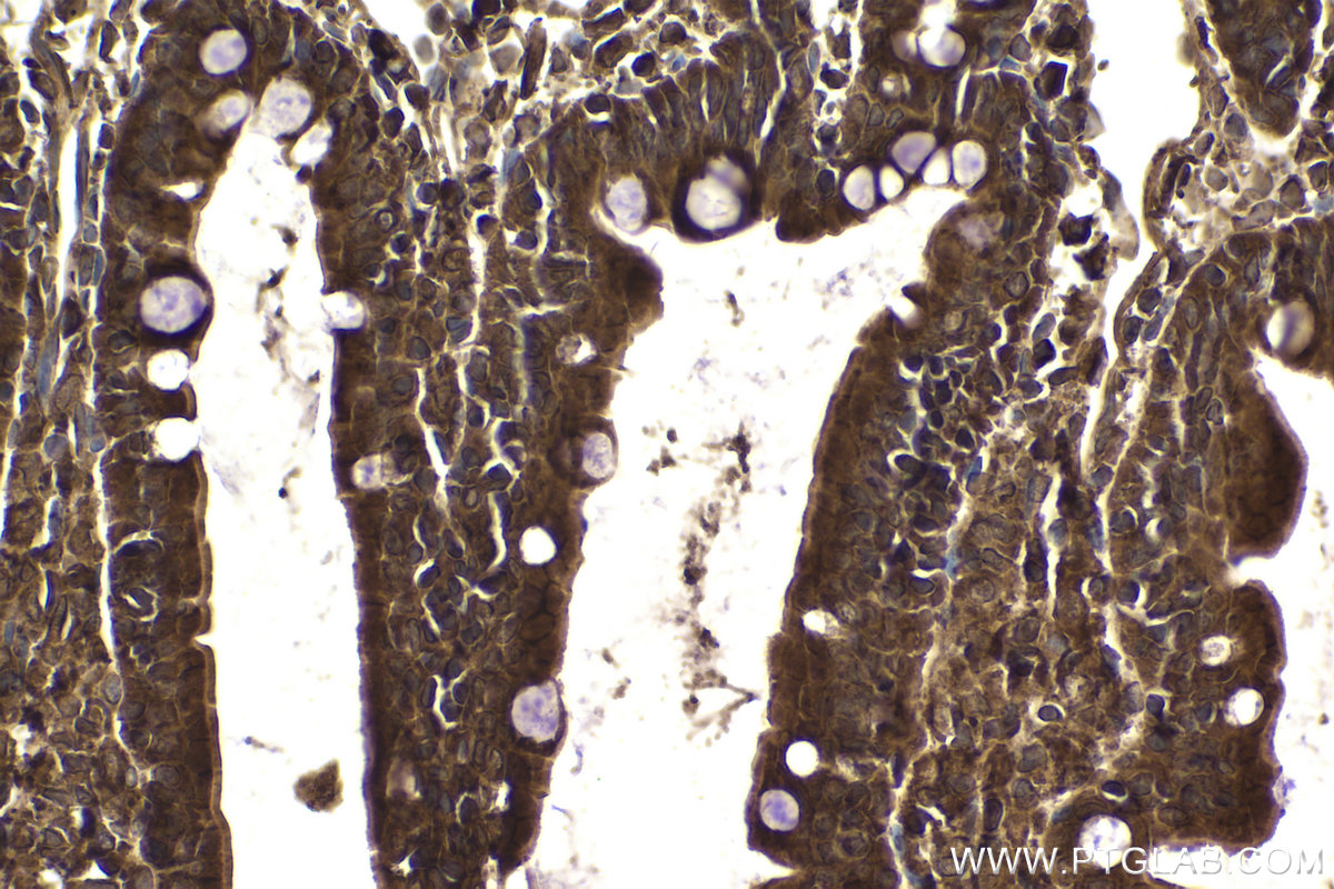 Immunohistochemical analysis of paraffin-embedded rat small intestine tissue slide using KHC1883 (ERBIN IHC Kit).