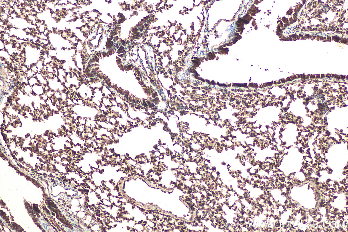 Immunohistochemical analysis of paraffin-embedded mouse lung tissue slide using KHC0917 (ERK1/2 IHC Kit).