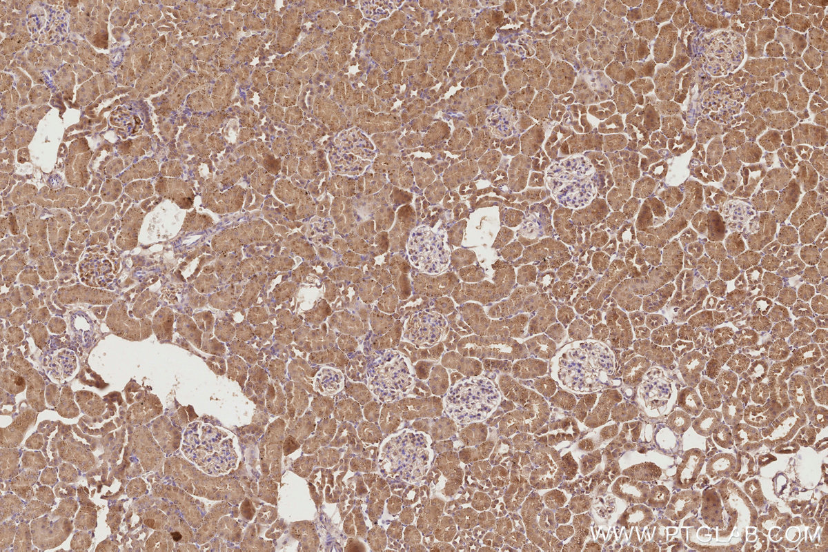 Immunohistochemical analysis of paraffin-embedded rat kidney tissue slide using KHC2861 (ESYT1 IHC Kit).